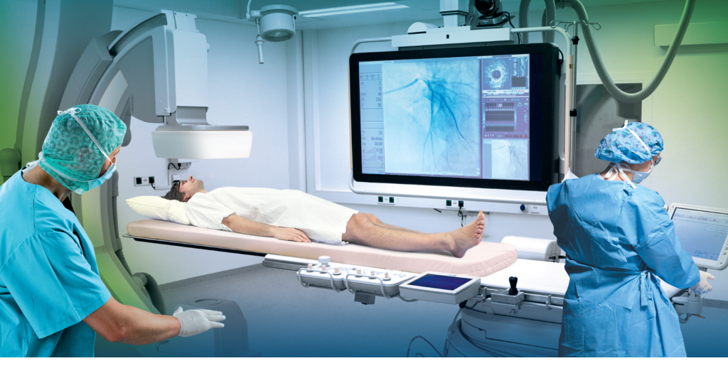 Comment la radiologie conventionnelle évoluetelle vers le numérique